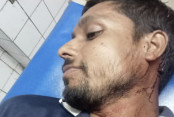 shornollata